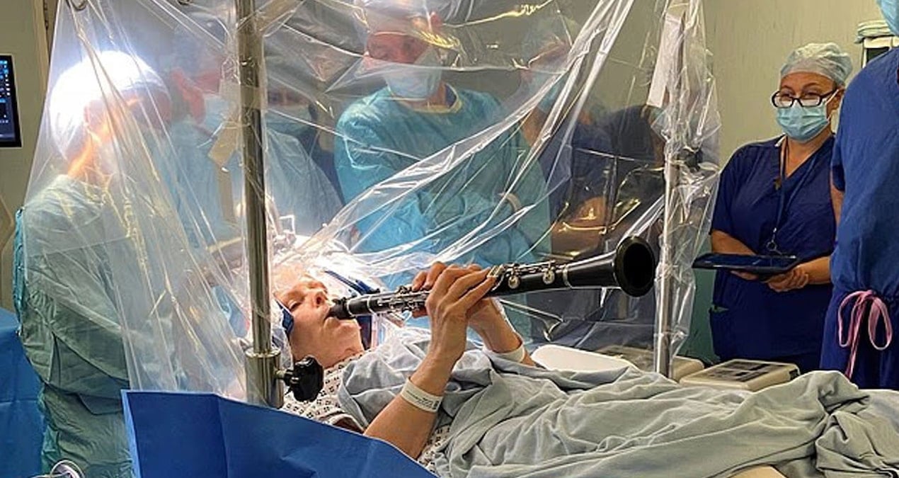 beyin ameliyati yapilirken klarnet calmaya devam etti AyB9RY4n.jpg