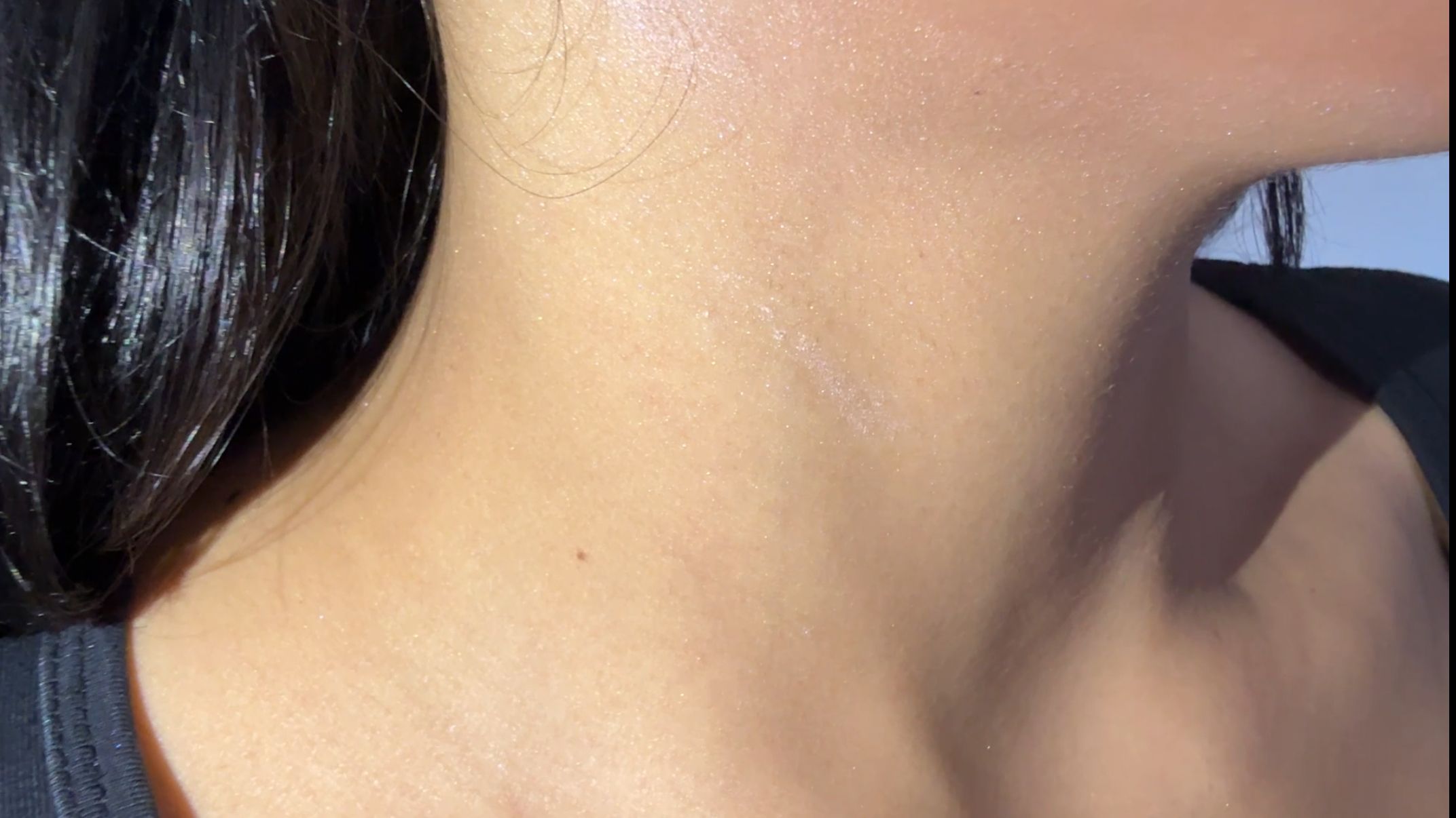 Hastanede alınan darp raporu