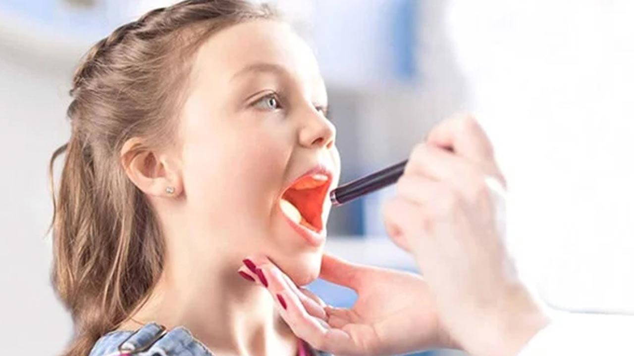 uzmani acikladi her bademcik sorunu ameliyat demek degil IbbGGcBK.jpg